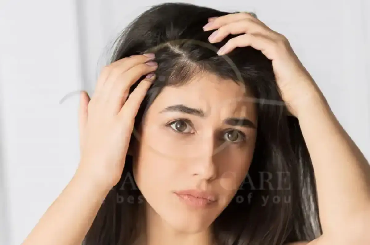 L'Adderall provoque la perte de cheveux