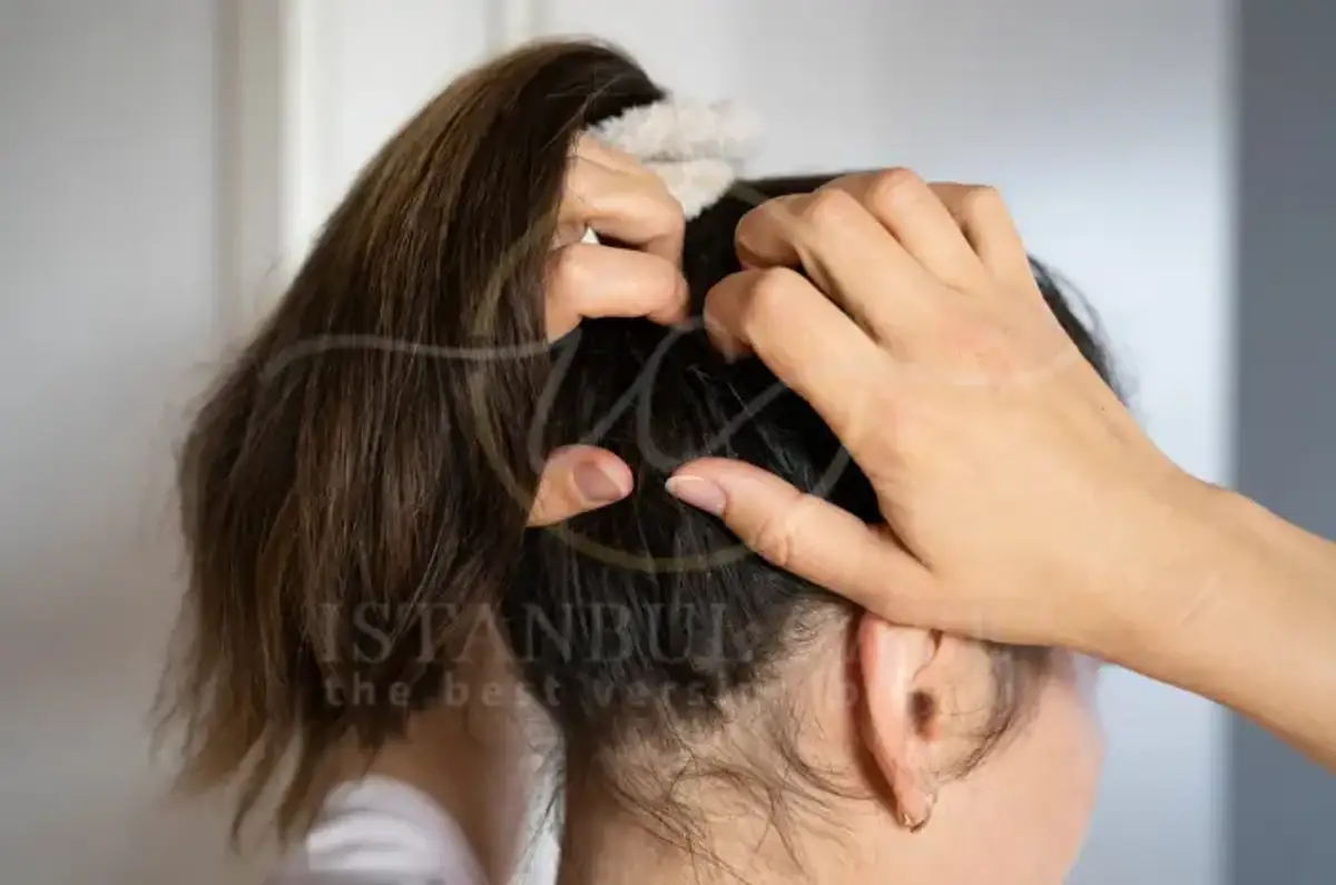 How to Fix Dry Scalp Best Causes Symptoms