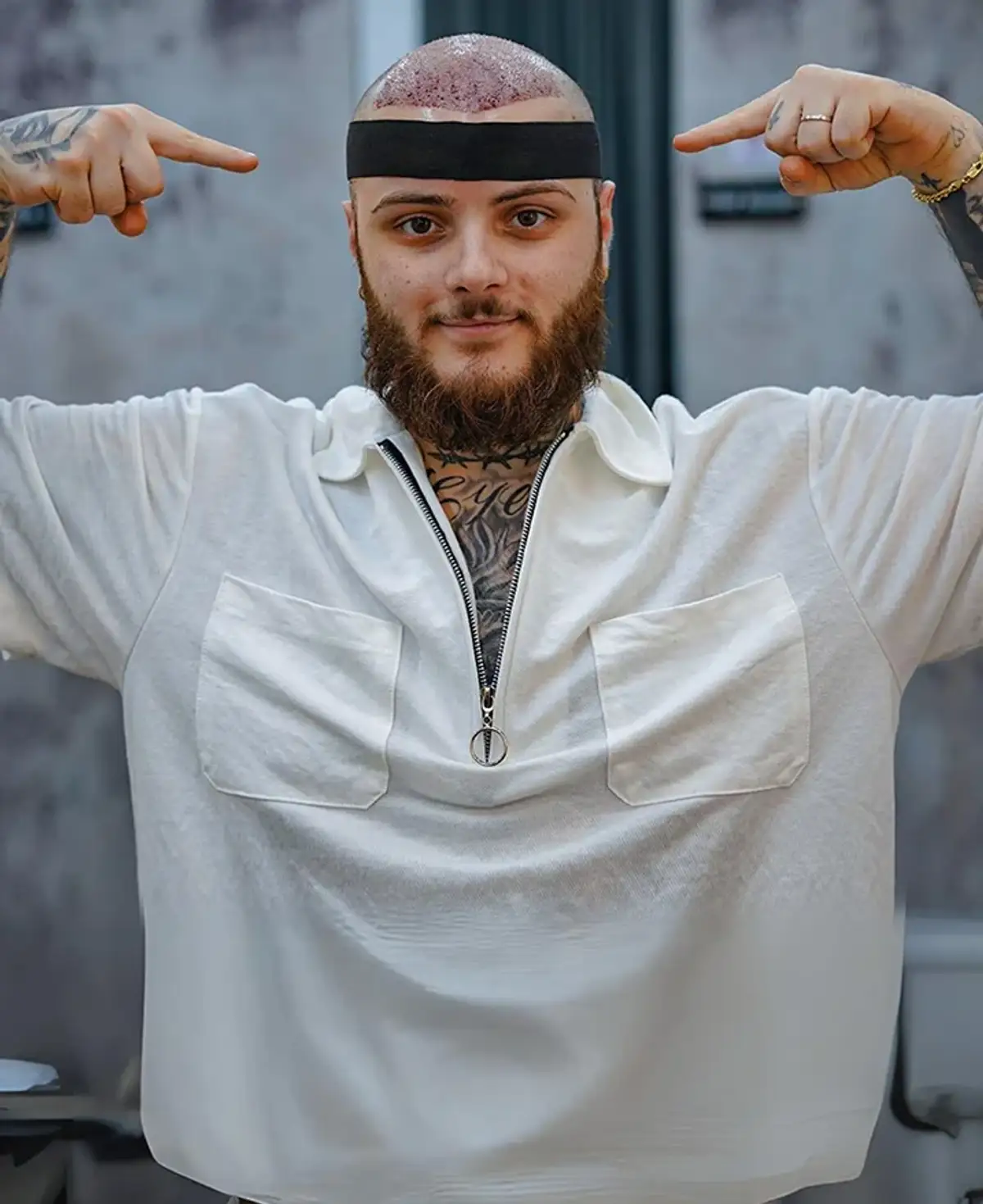 An unidentified patient in a white shirt with a shaved, freshly grafted scalp and a headband, pointing at his own head with both hands.