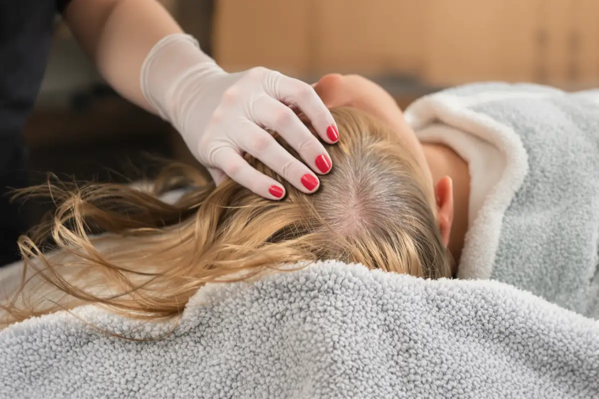 الصلع في سن العشرين: هل يجب أن تفكر في زراعة الشعر؟
