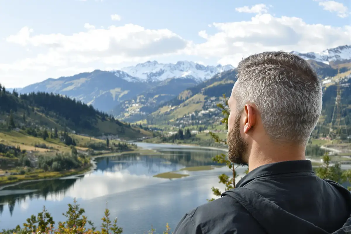 Le guide ultime pour la greffe de cheveux FUT