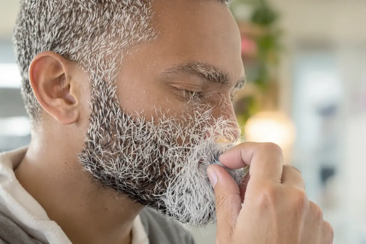 Minoxidil per la Crescita della Barba: Guida Completa