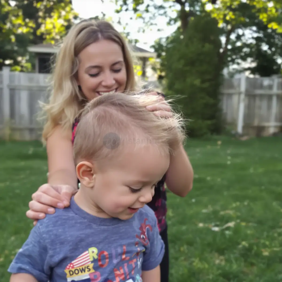 Man at the crown of the head where a cowlick whorl can be mistaken for early hair thinning