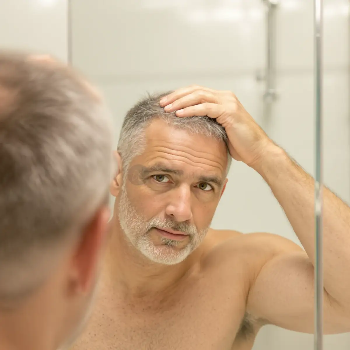 Hombre inspeccionando su cabello ralo en un espejo antes de comenzar la terapia de luz roja para el crecimiento del cabello