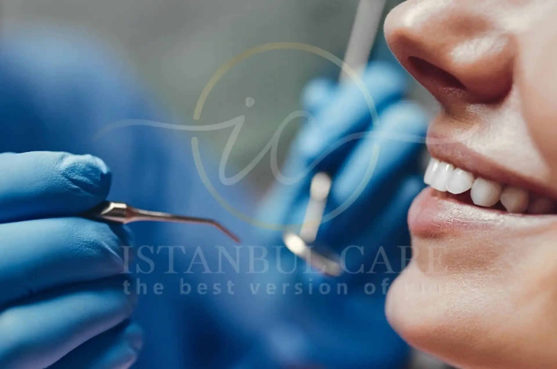 All-on-4 Dental Implants: Preparation and Pre-Surgery Guid