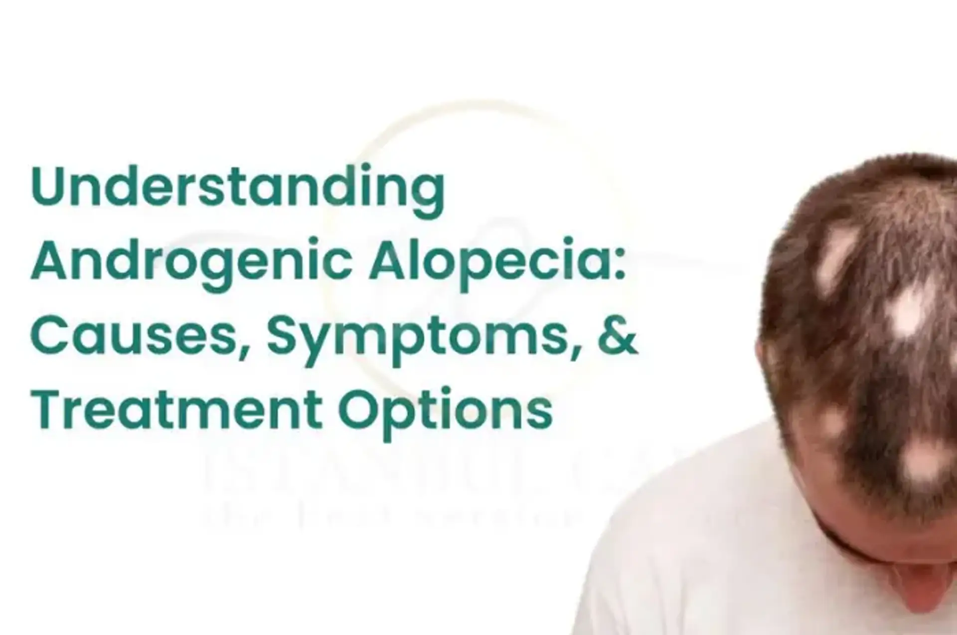 Understanding Androgenic Hair Loss Causes and Mechanisms