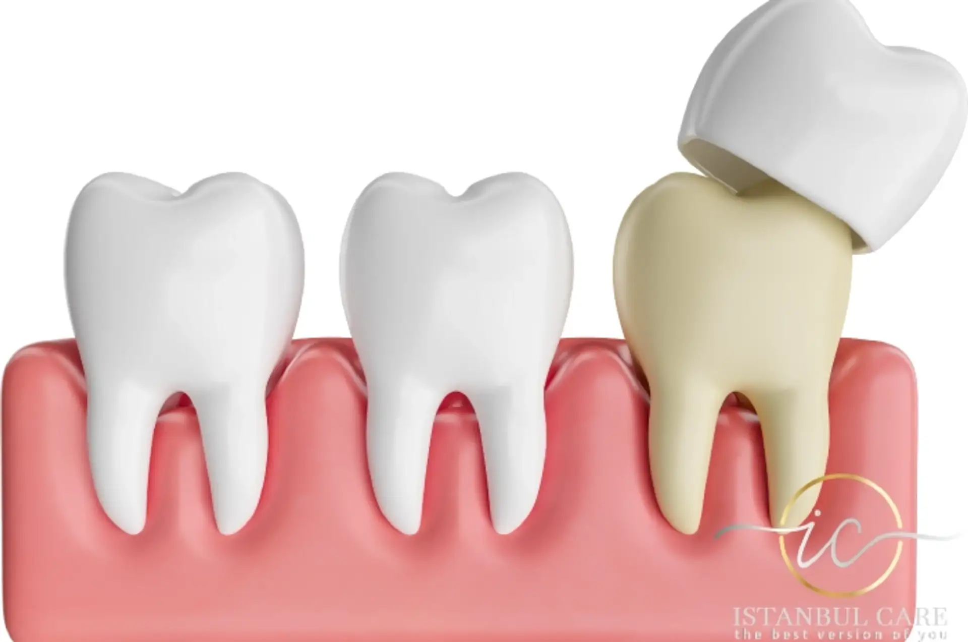 Types of Dental Treatments in Albania