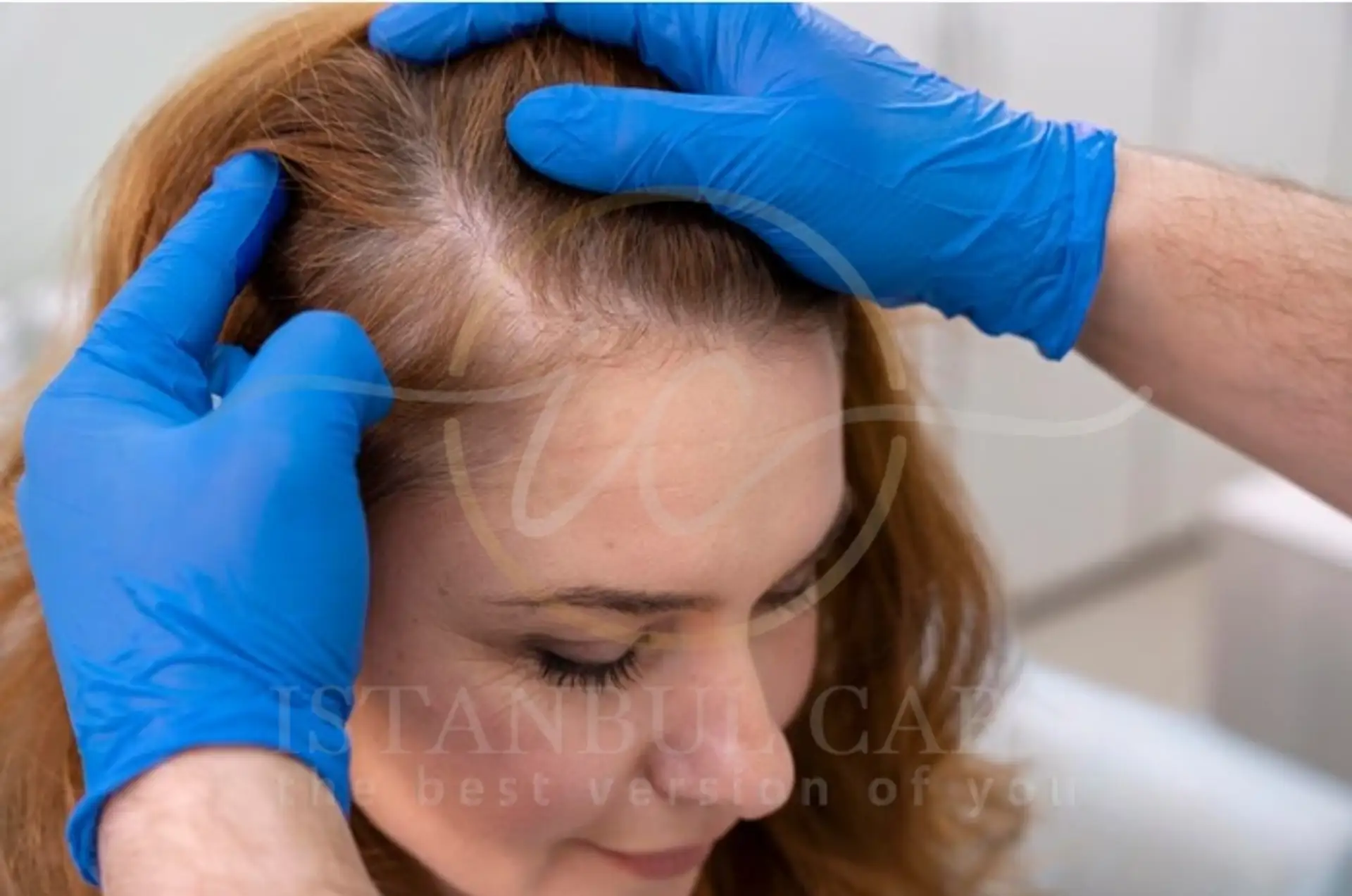 How Hair Papilla Cells Trigger Follicle Induction and Regrowth