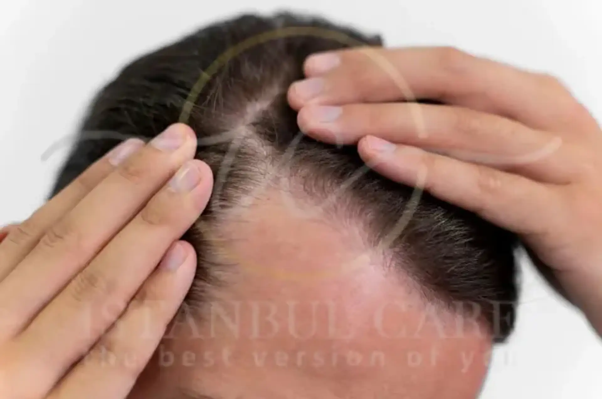 Expert Tips for Healthy Hair