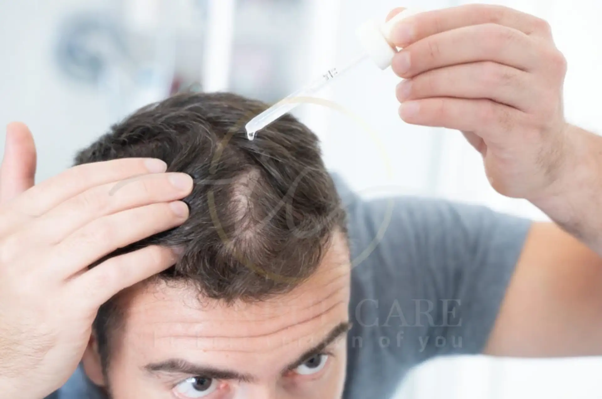 Finasteride Uses for Hair Loss Benefits and Risks
