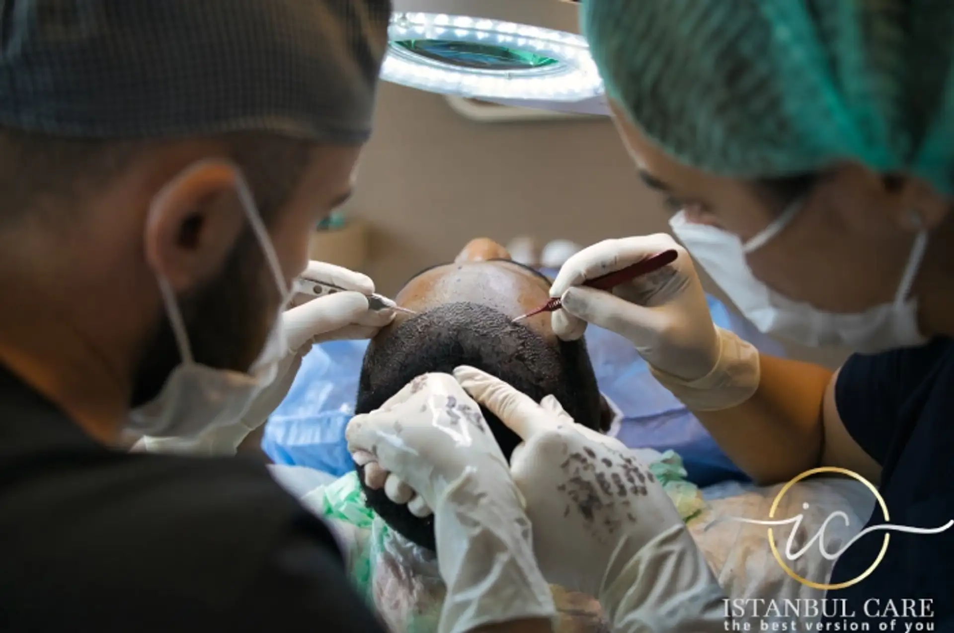 Hair Transplantation for HIV Patients in Turkey