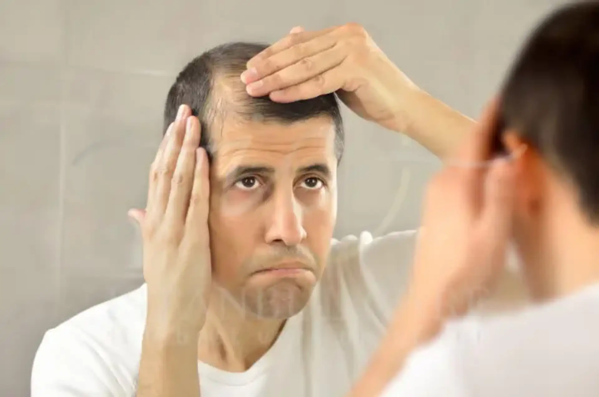 Lupus Hair Loss Symptoms Causes and Treatments