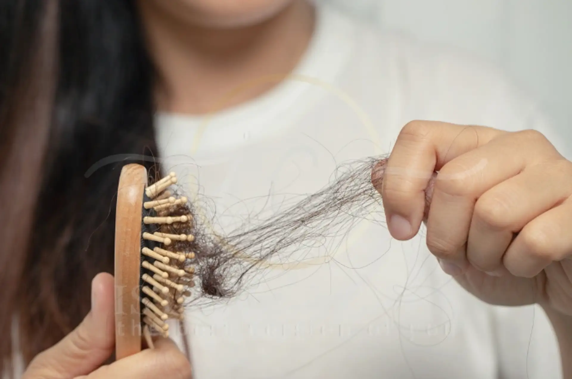 Understanding COVID Hair Loss Causes and Recovery