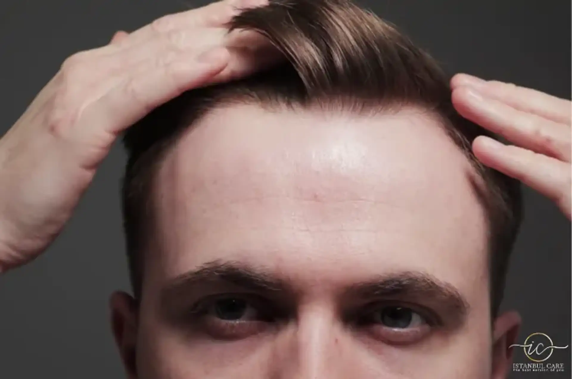 Capelli vaporosi: i migliori tagli per stempiature e stile