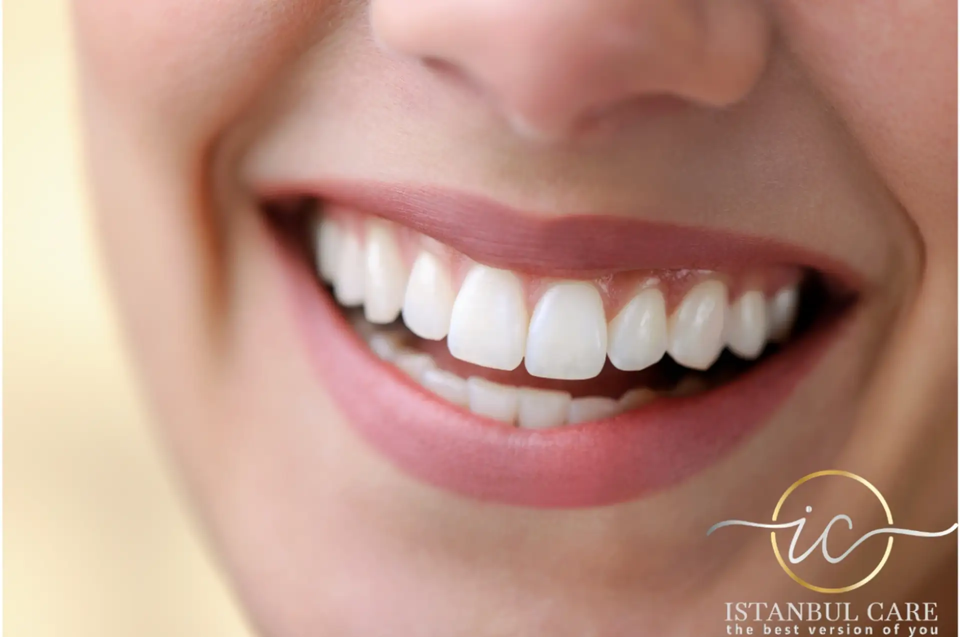 Why Choose Invisalign in Albania for Your Perfect Smile?