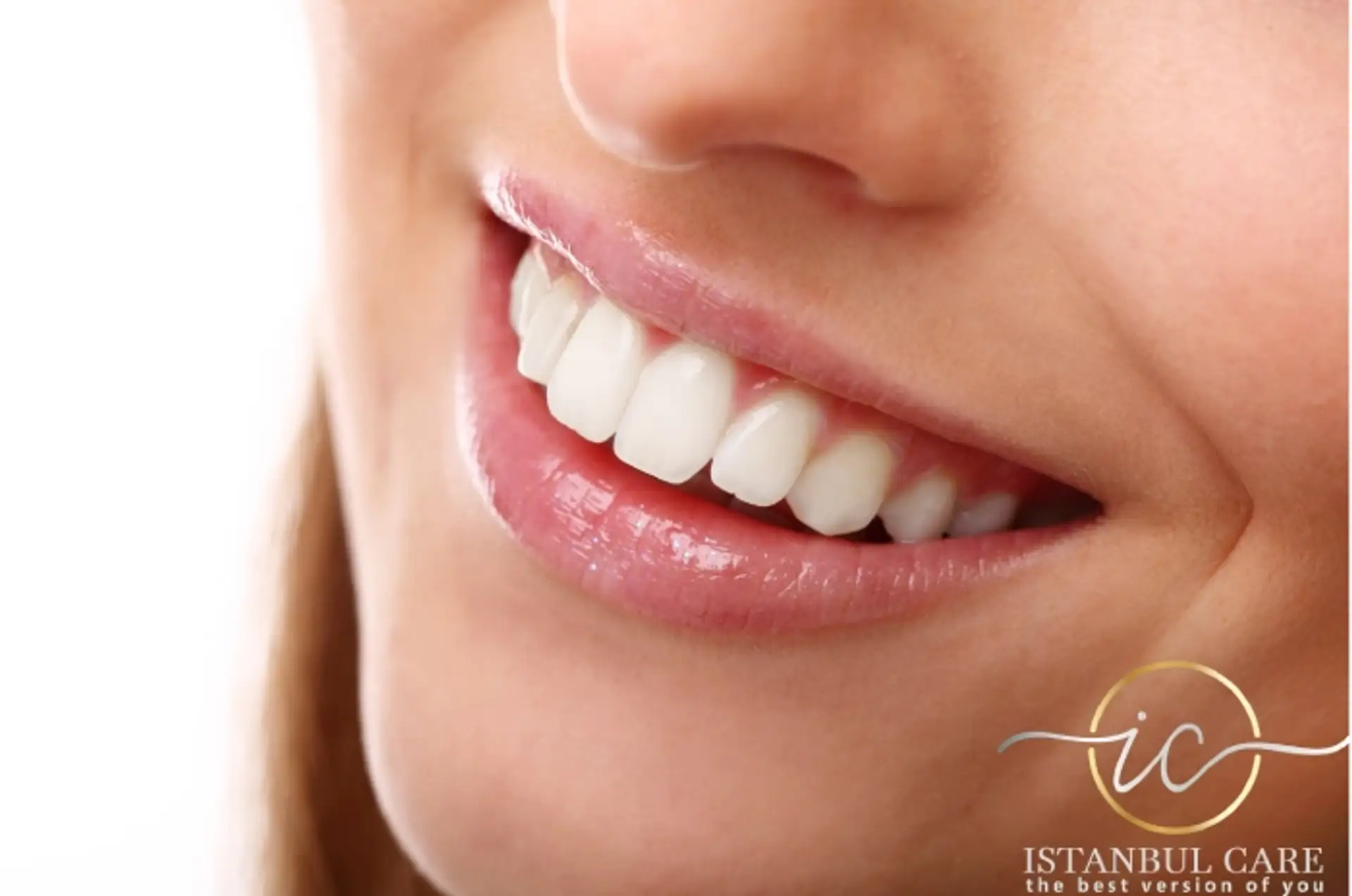Remodelação do sorriso na Turquia - Cuidados dentários excepcionais