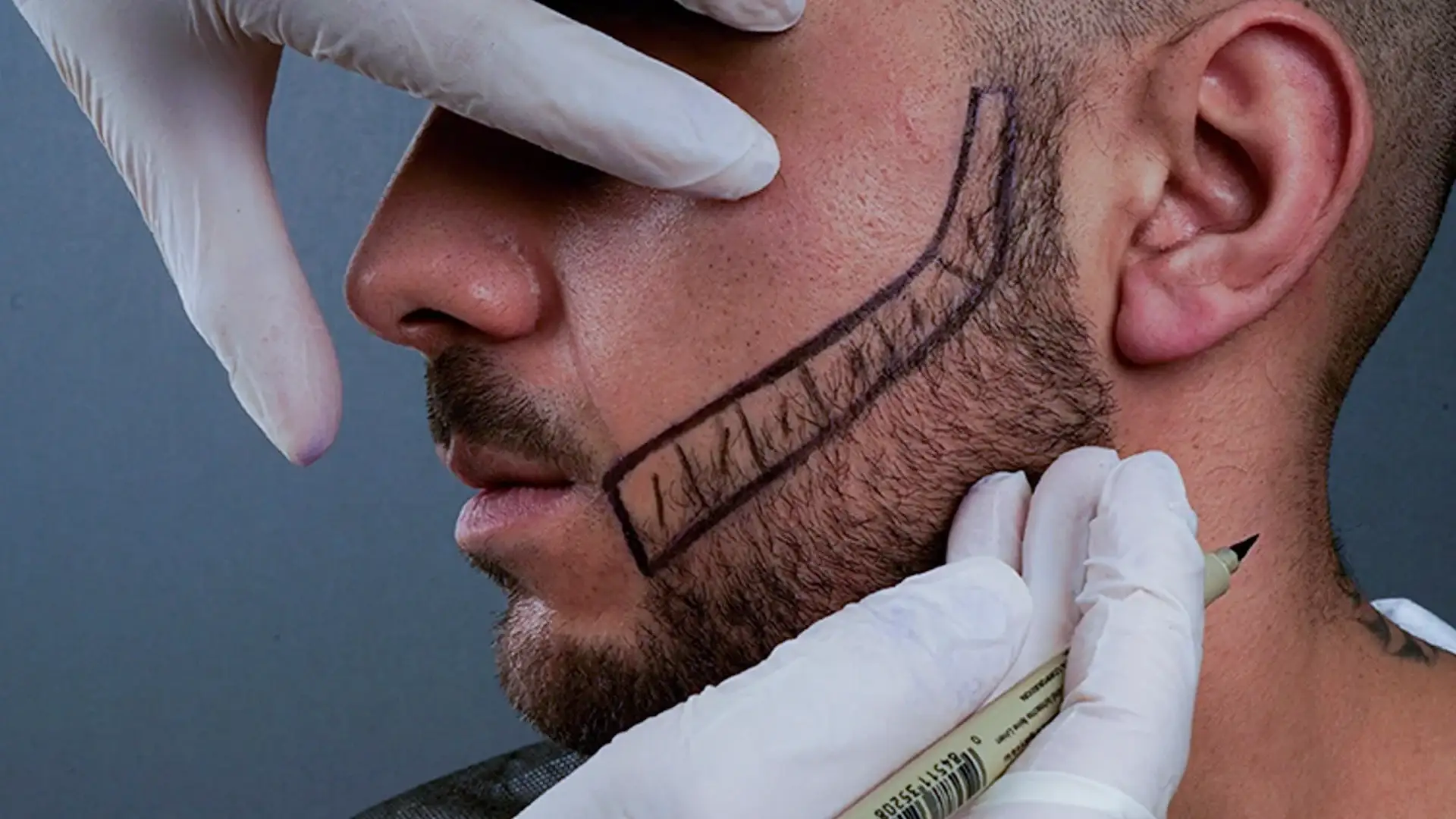 beard-doctor