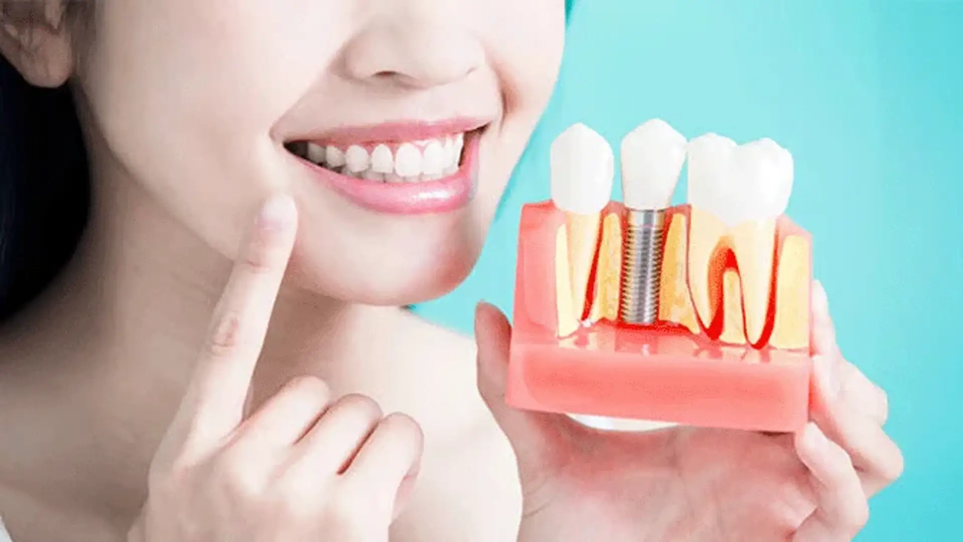 Healing After Dental Implant Surgery