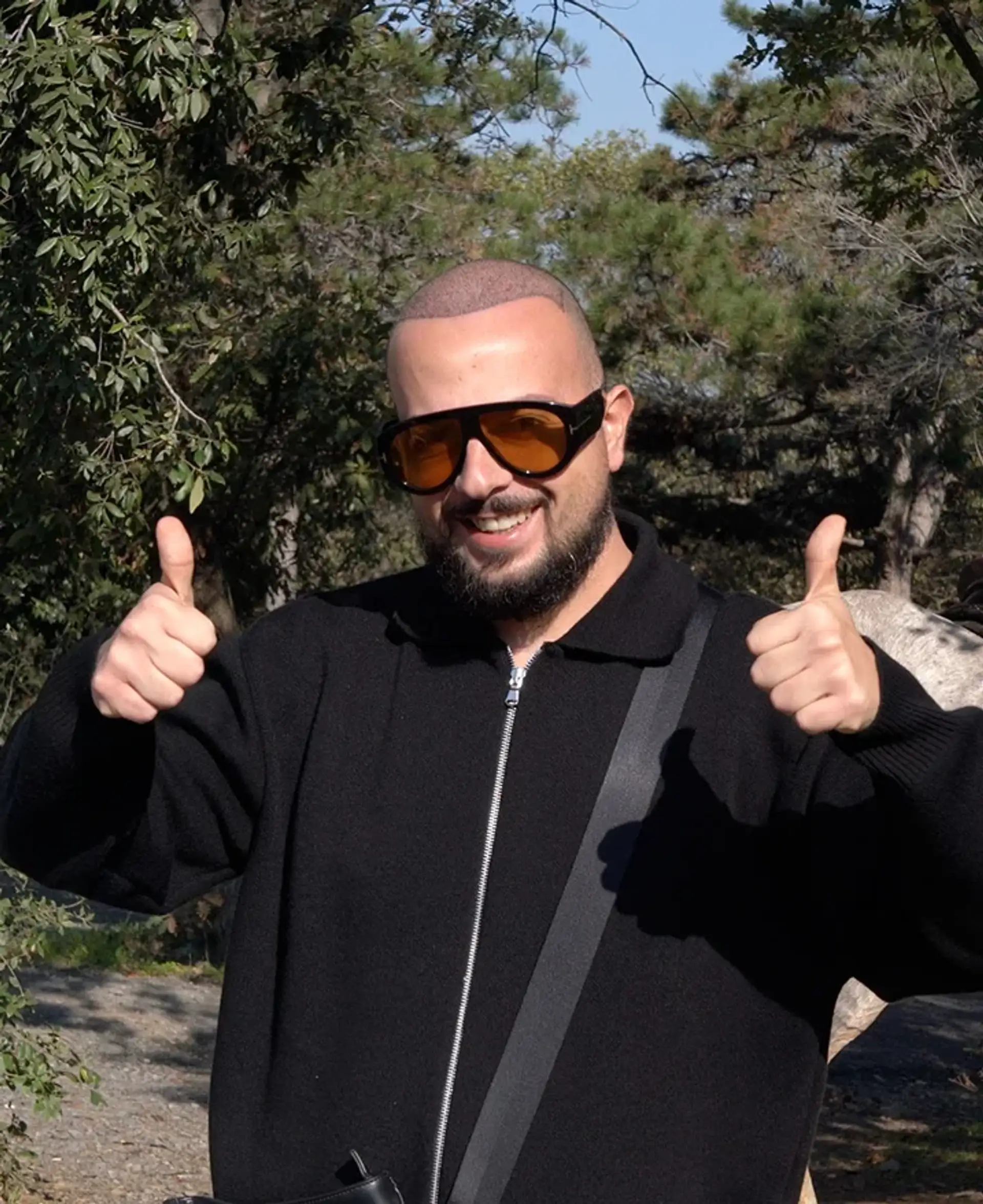 Avis sur la greffe de cheveux en Turquie