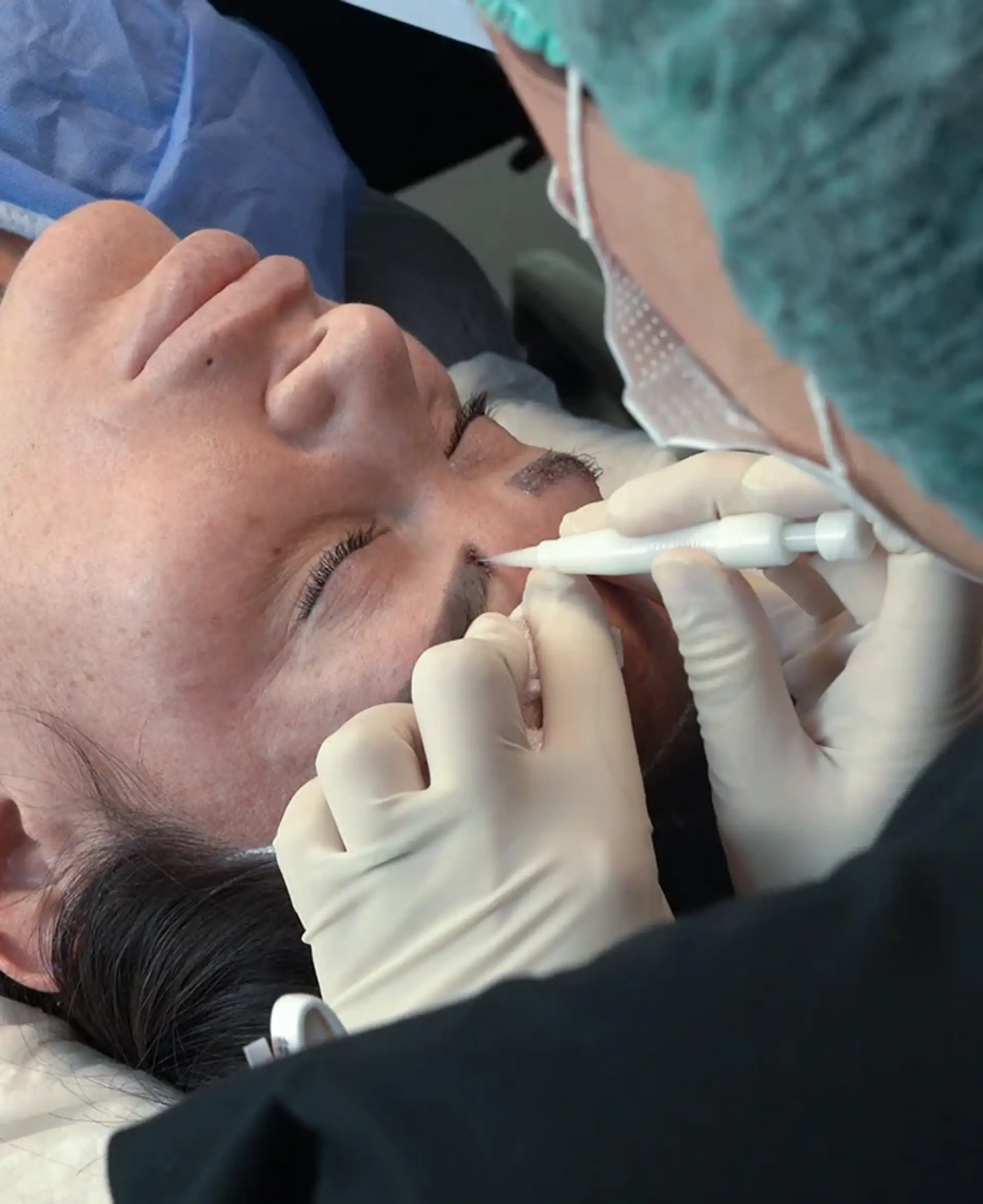 Wenn die Augenbrauentransplantation nicht empfohlen wird