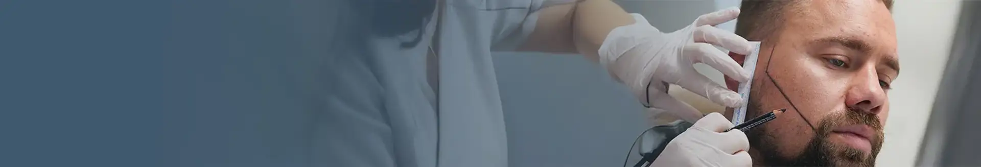 Trapianto di Peli della Barba