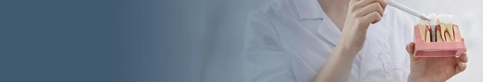 Implant Treatment in Turkey
