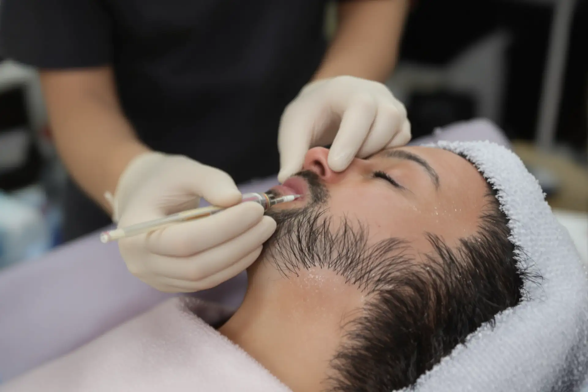 Përfitimet e transplantit të flokëve pa gjilpëra