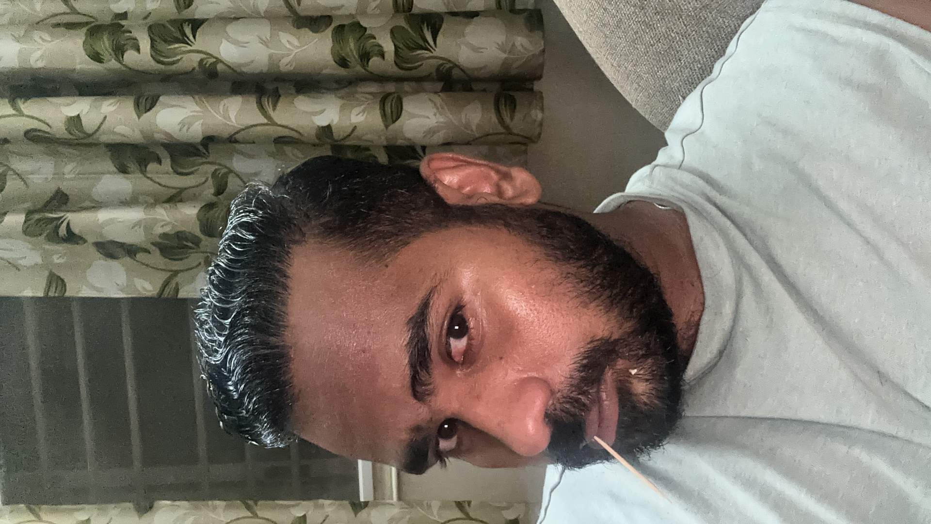 Essential Questions for Hair Transplant Consultations