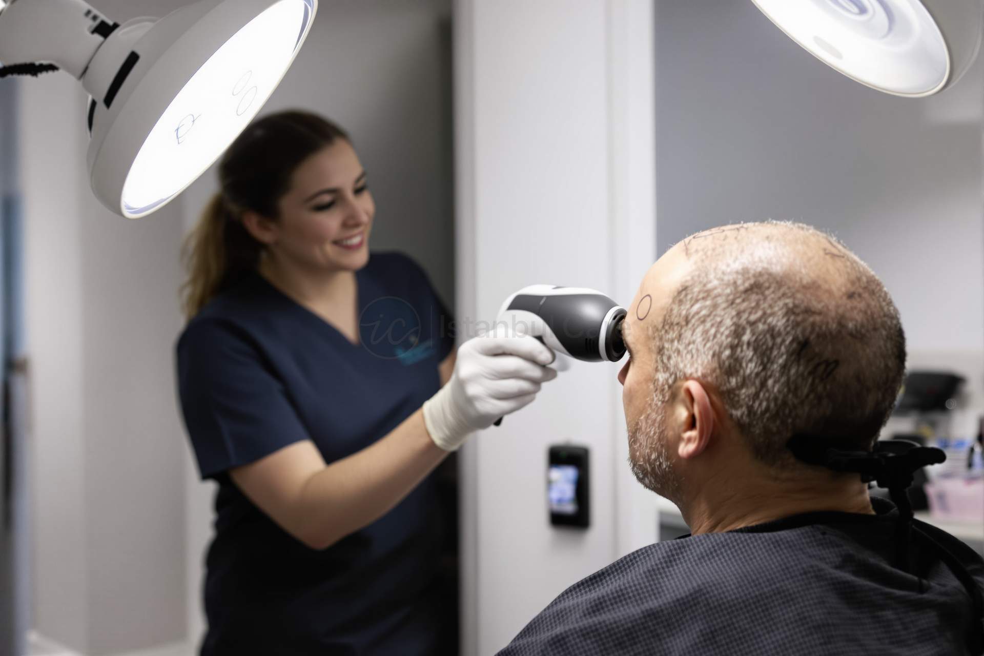 7000 Grafts Hair Transplant Before and After