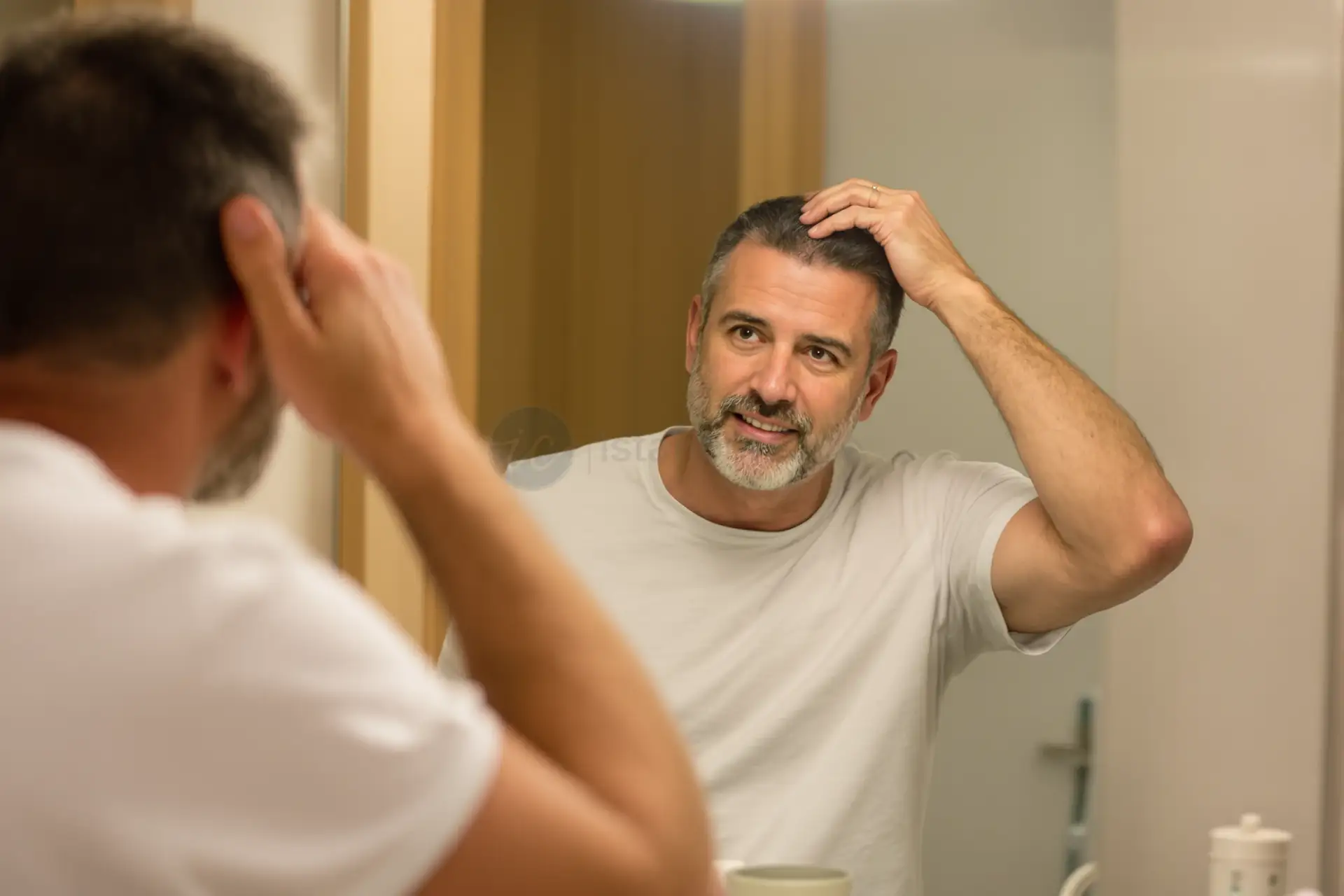 how long do hair transplants last — overview