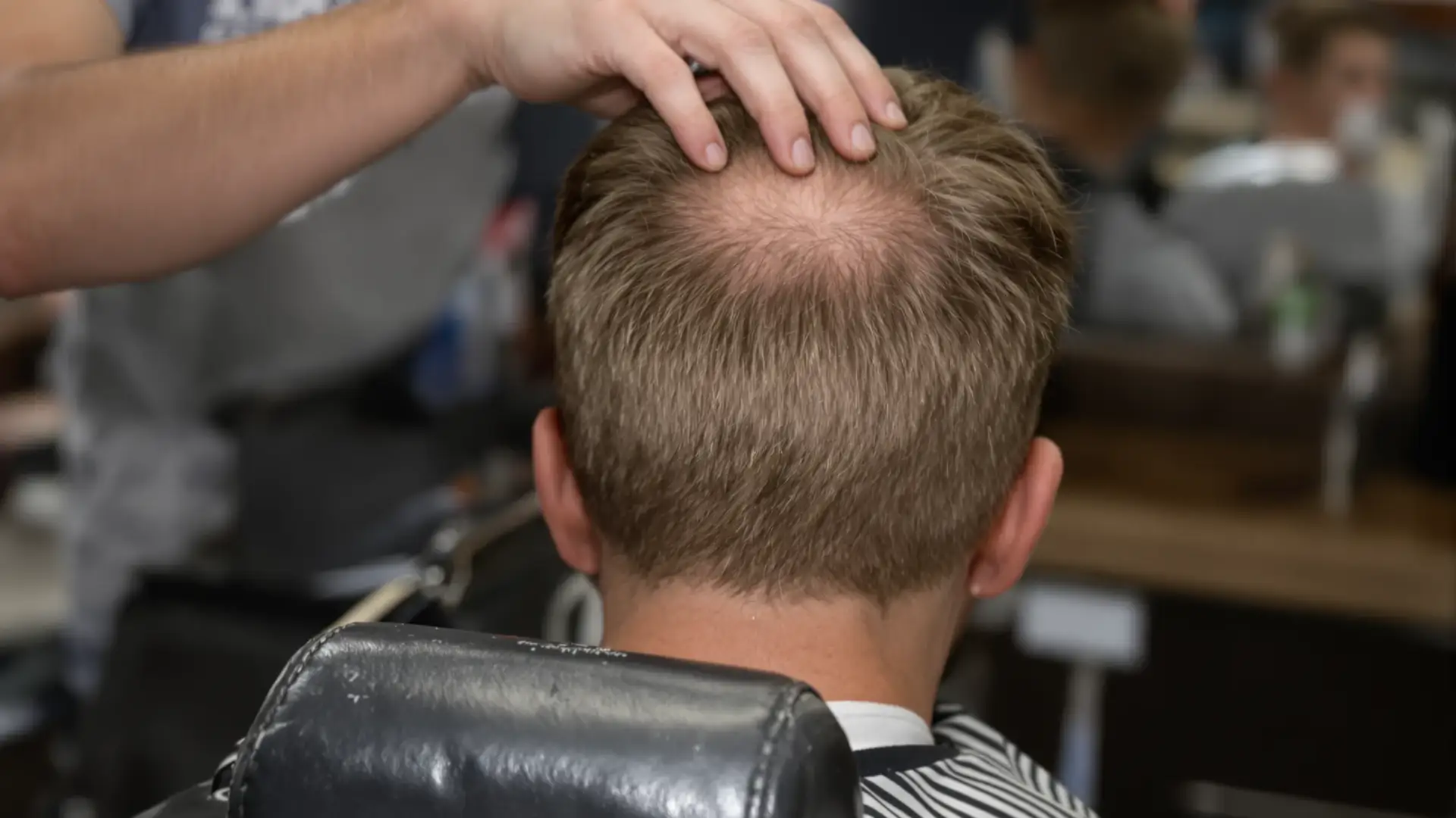 Logan Paul Hairline: A Photo-Based Analysis