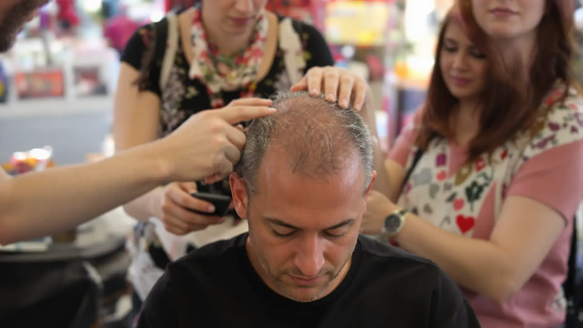 Clinic staff examining the thinning crown and hairline of a seated middle-aged man during a hair transplant scalp assessment in Istanbul