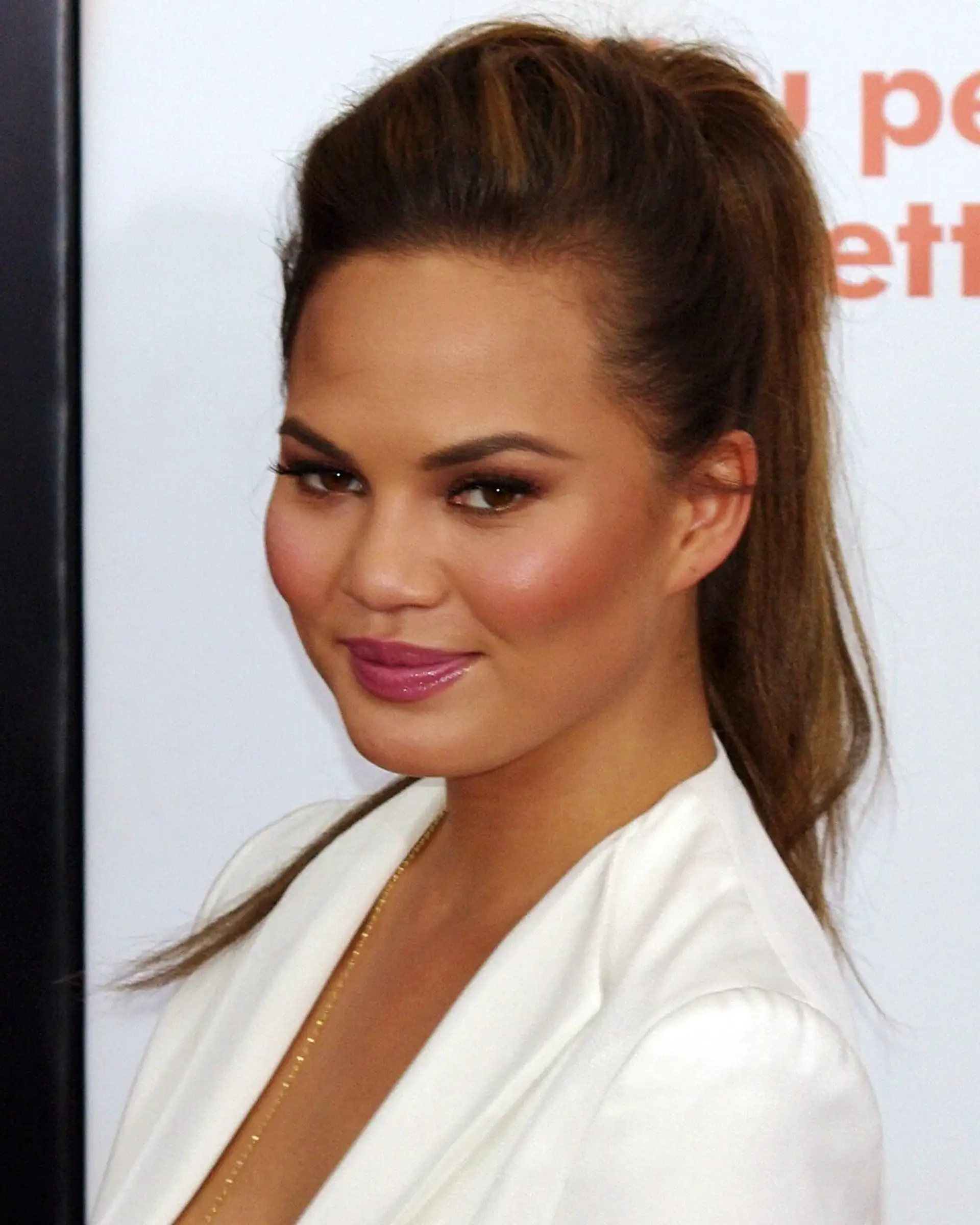 Chrissy Teigen, photographed in public. Licensed image; not evidence of any procedure.
