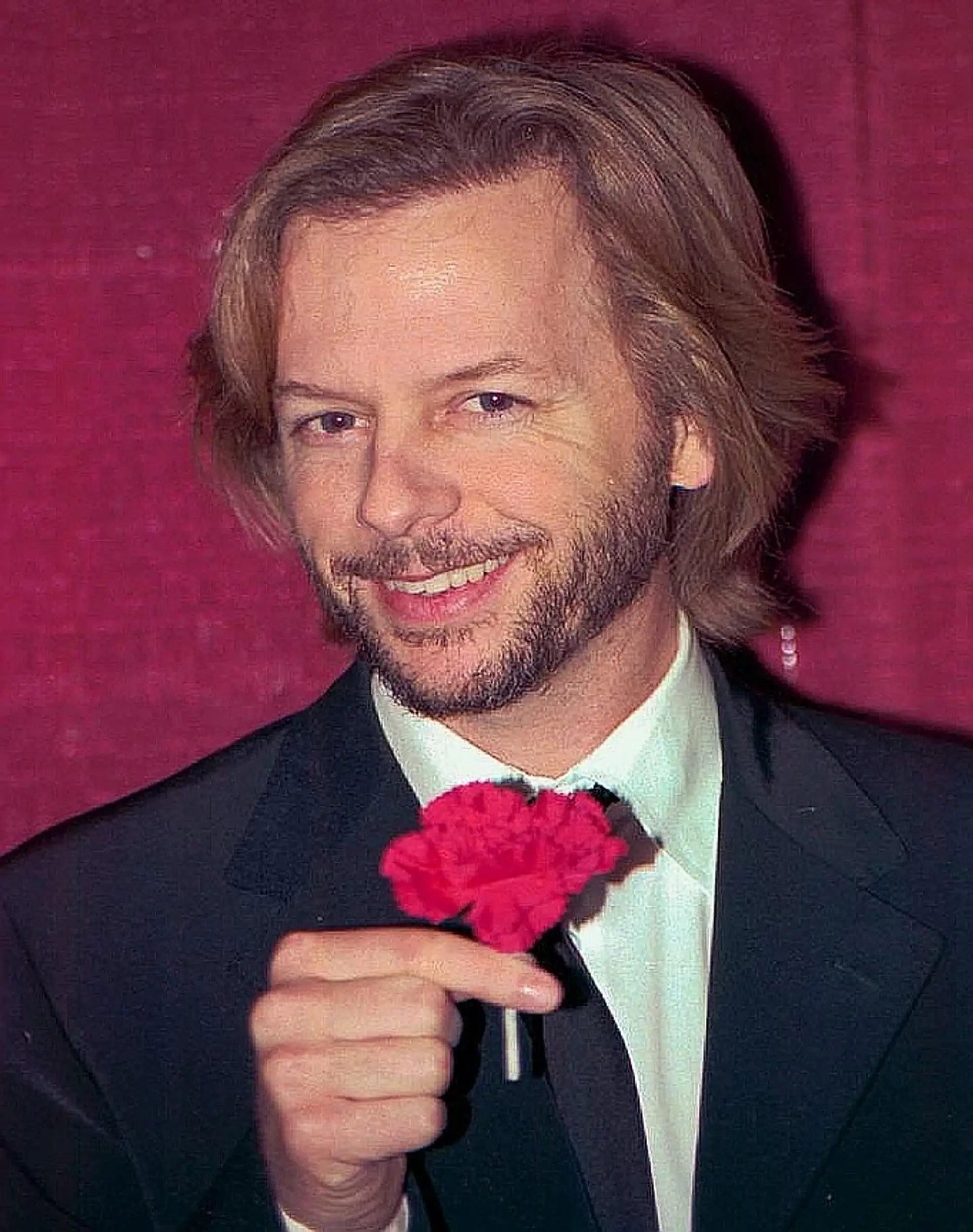 David Spade, photographed in public. Licensed image; not evidence of any procedure.