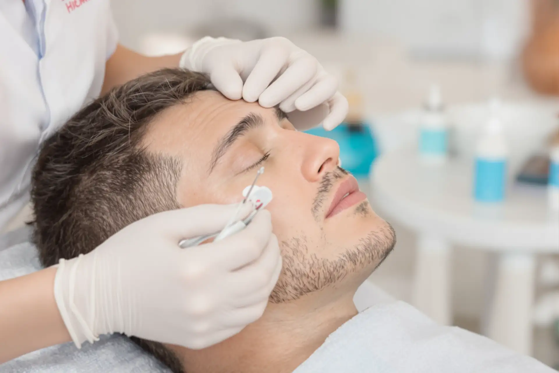 ¿Duele un Trasplante de Cabello? Informes de Pacientes