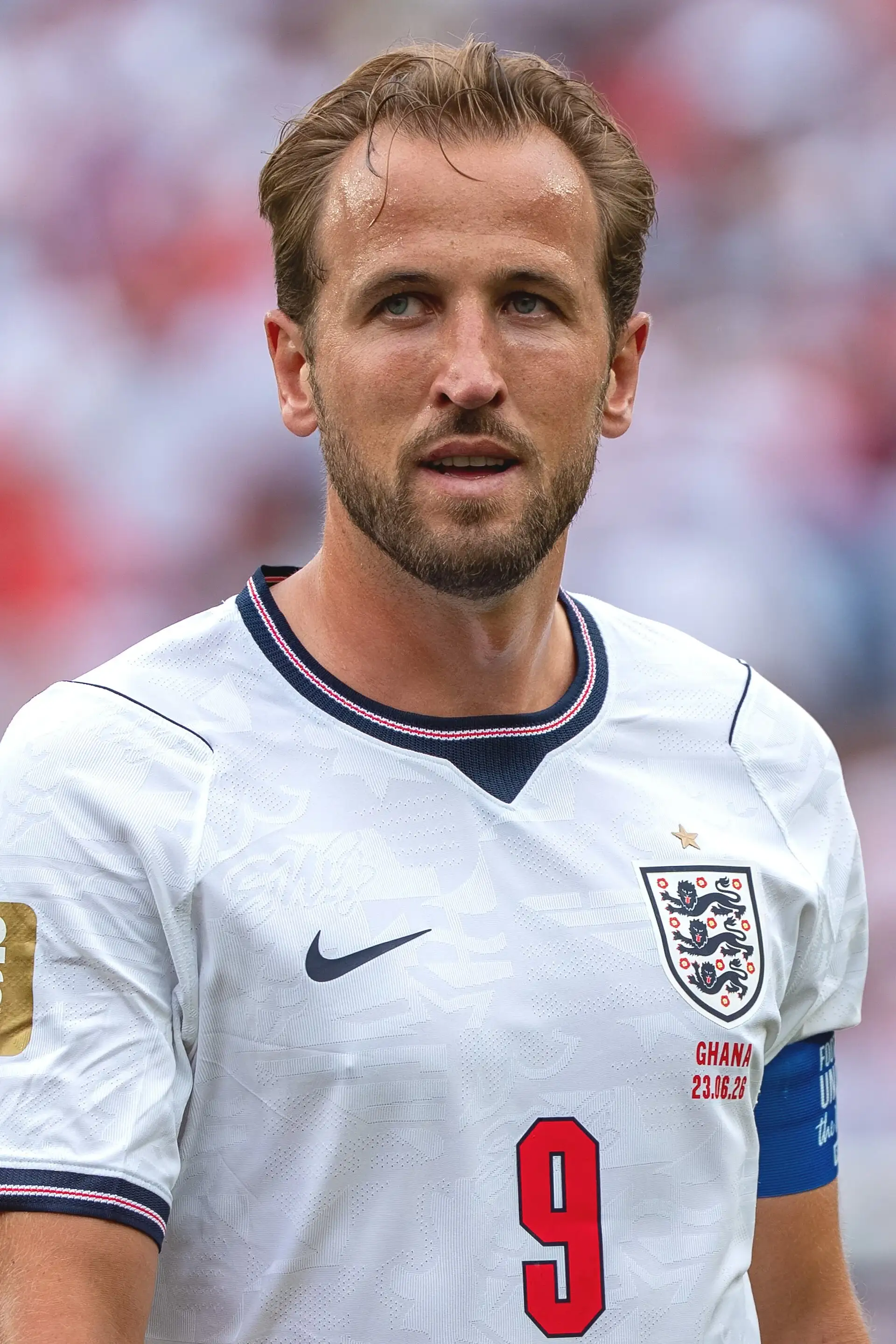 Trapianto di capelli di Harry Kane: cosa si sa davvero