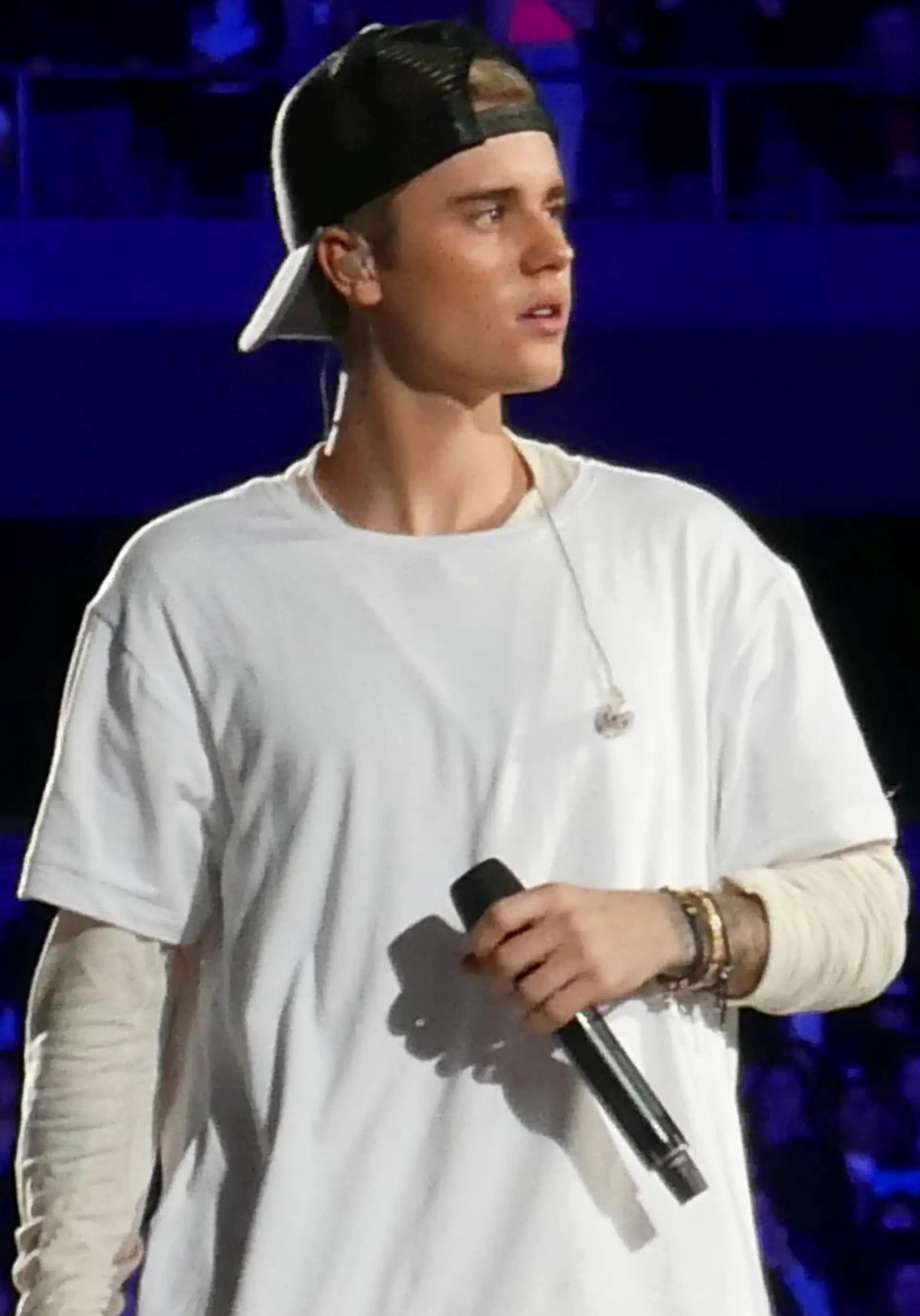Justin Bieber, photographed in public. Licensed image; not evidence of any procedure.