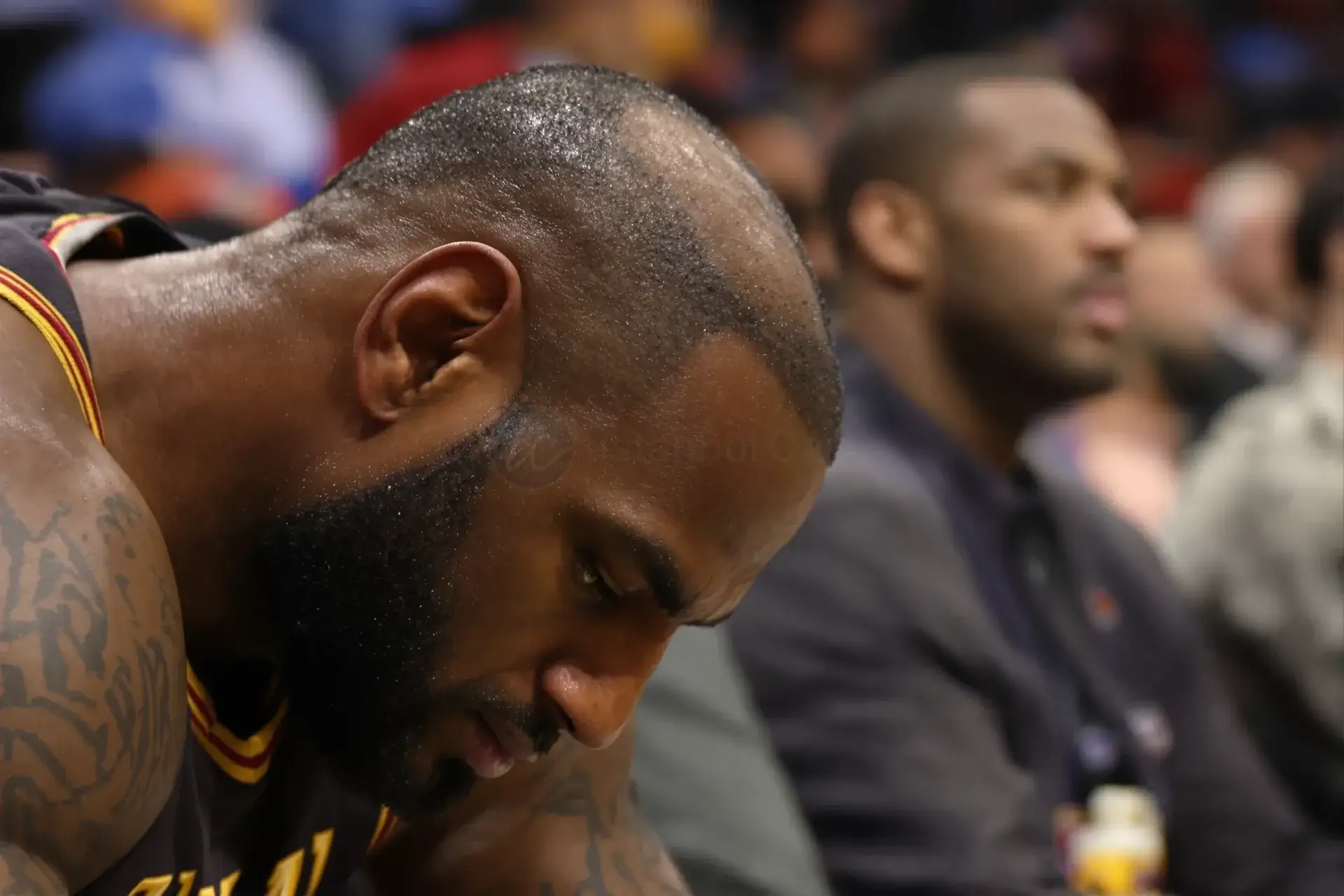 LeBron Calvo: La Verità Sulla Sua Perdita di Capelli