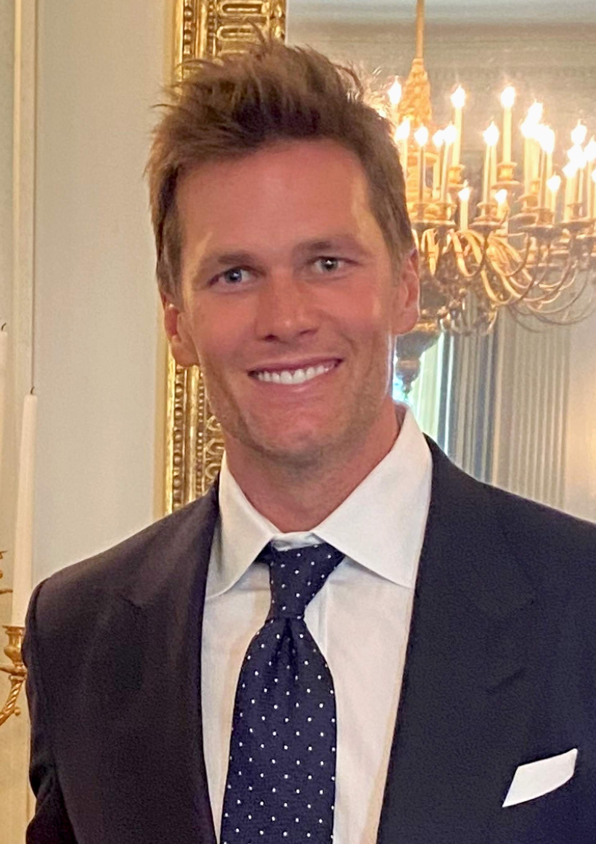 Tom Brady, photographed in public. Licensed image; not evidence of any procedure.