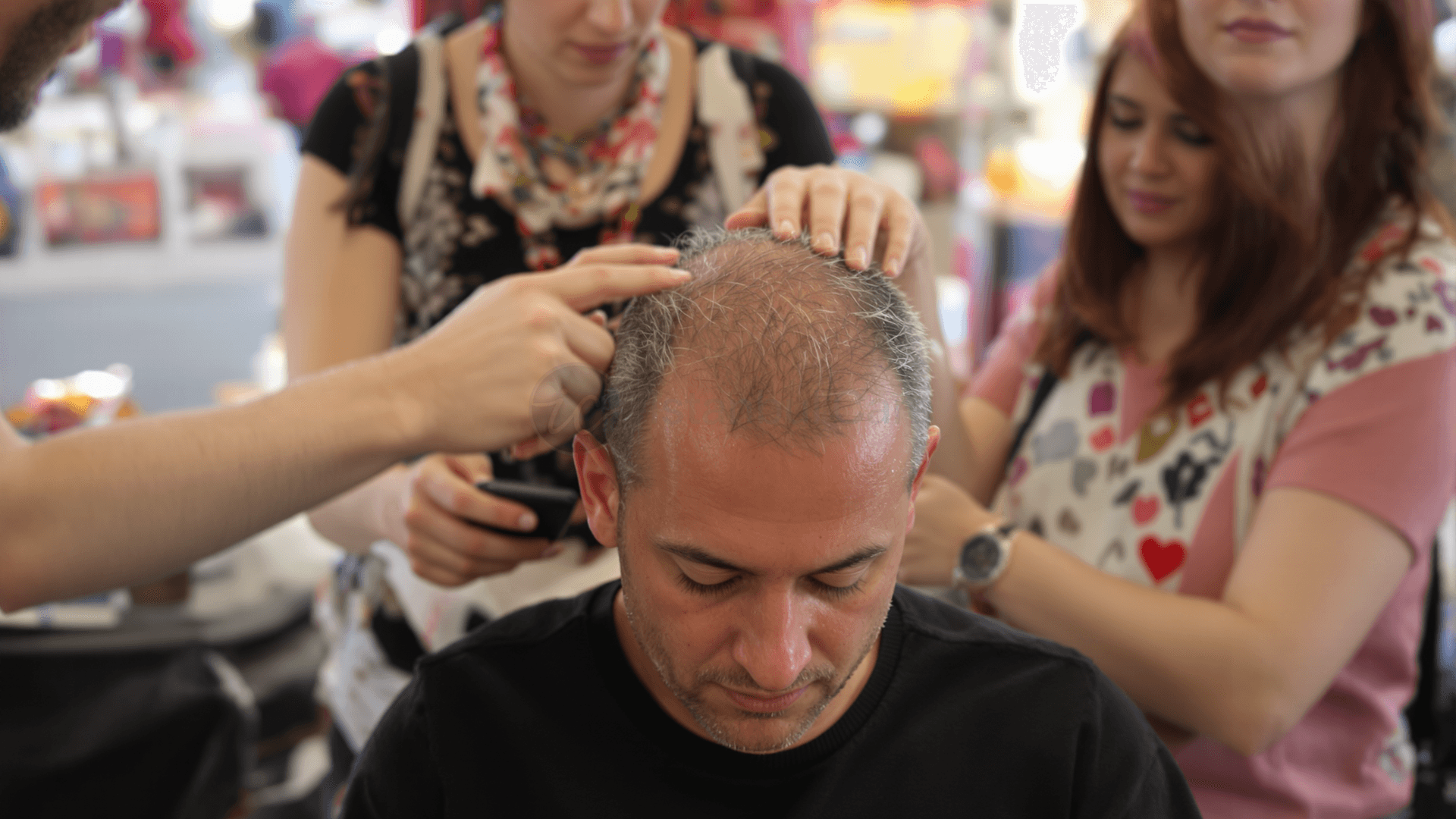 Hair Transplant in Turkey 2026: Clinic Ratings, Costs and How to Choose