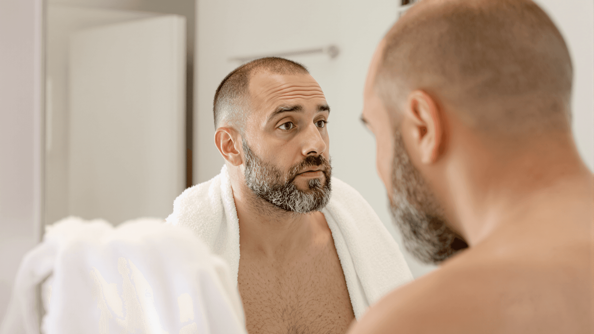 Bearded man looking at his reflection, beard donor area clearly visible.