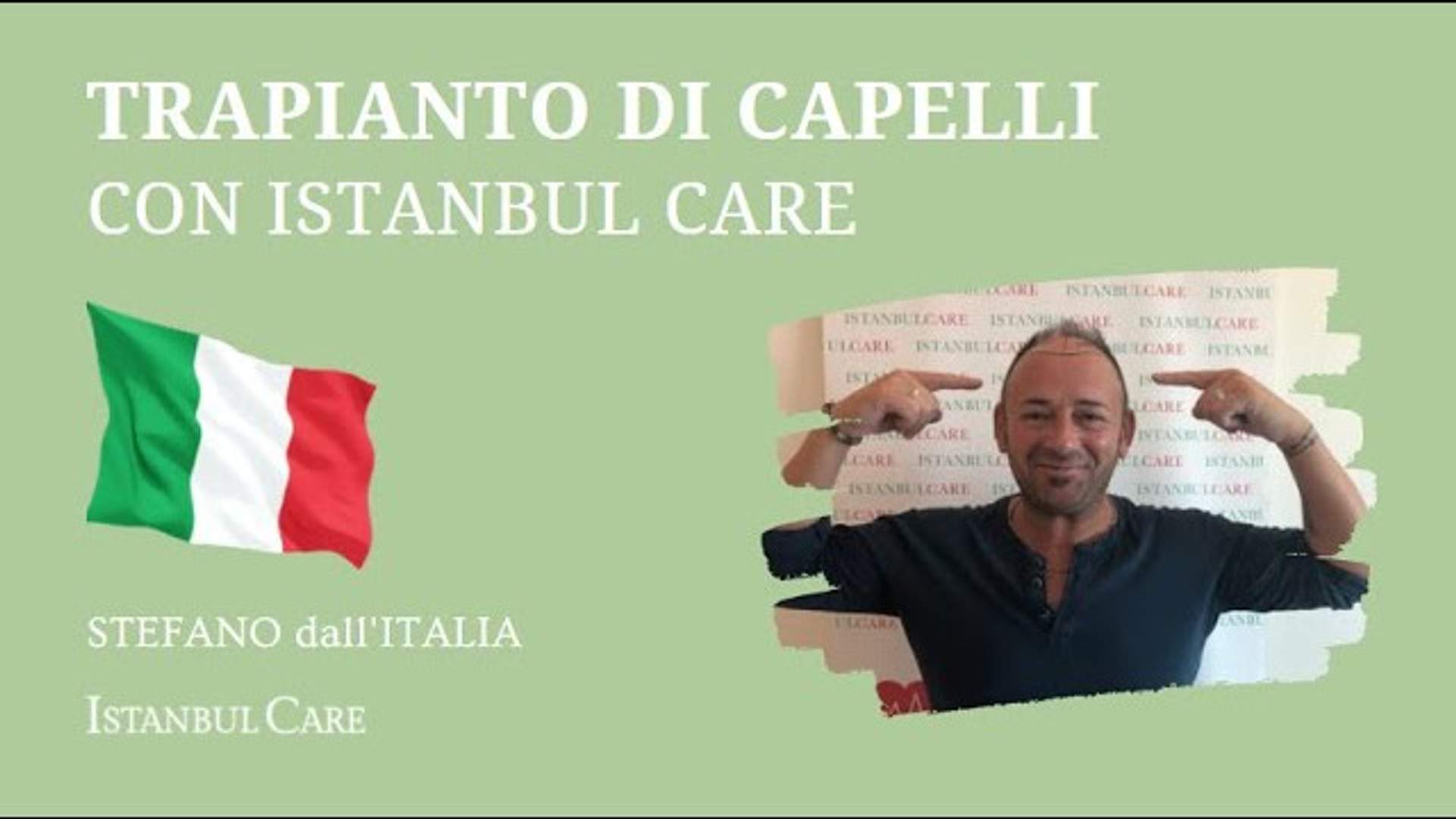 Stefano's Hair Transplant Story from Italy (Video)