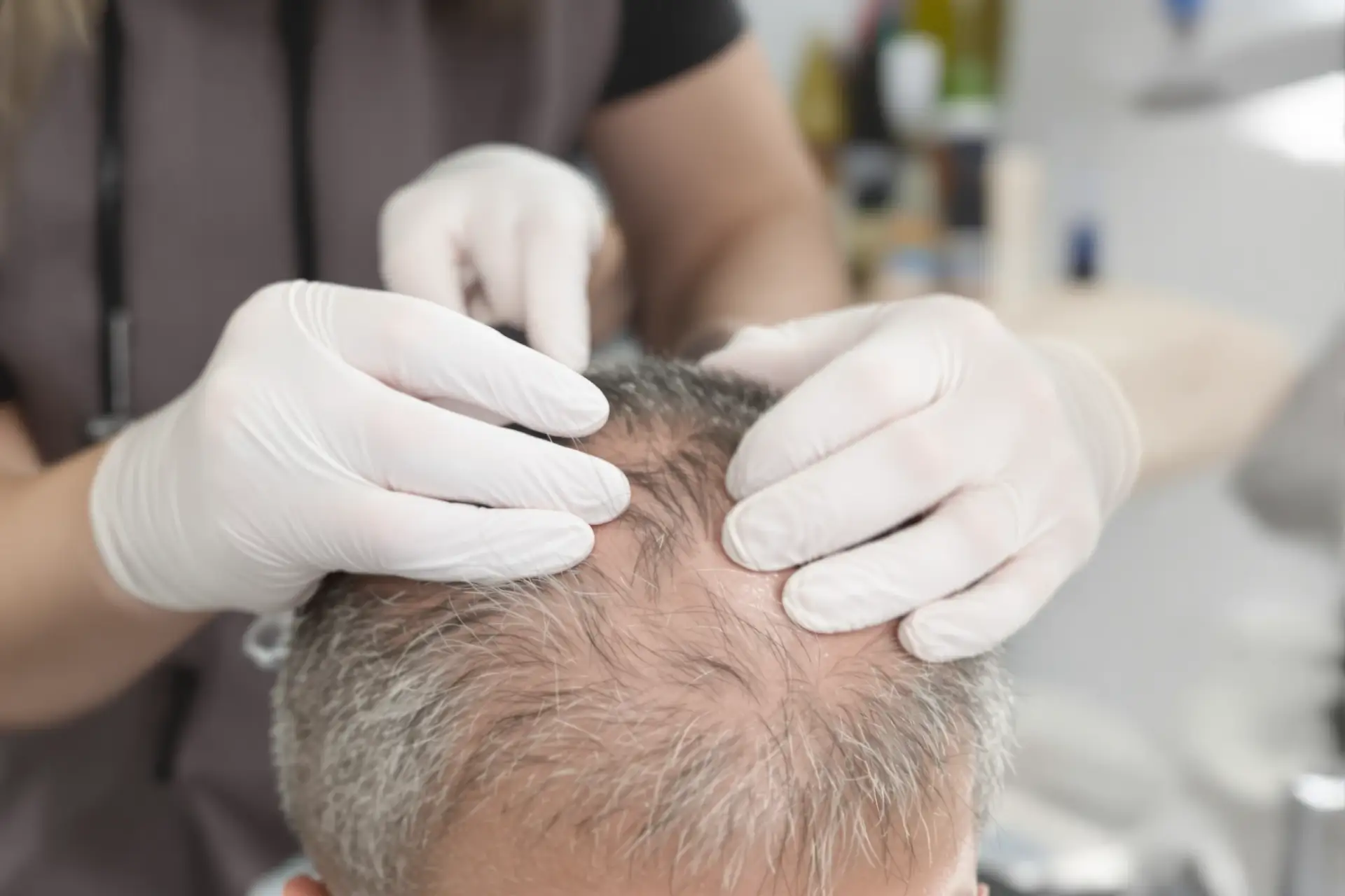 Hair Transplant Cost Turkey 2026: Full Price Breakdown