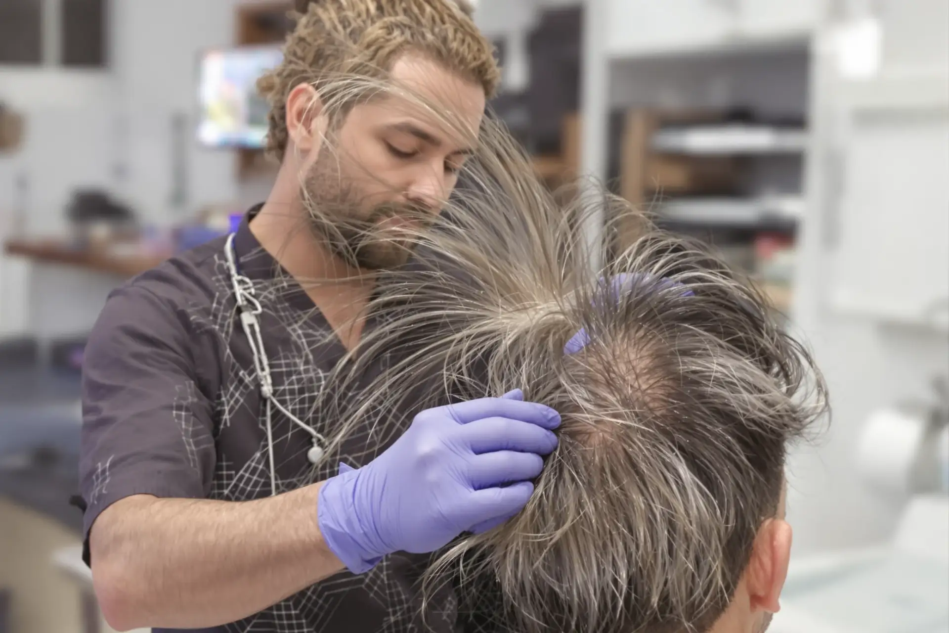 Taux de réussite de la greffe de cheveux en Turquie : Les faits