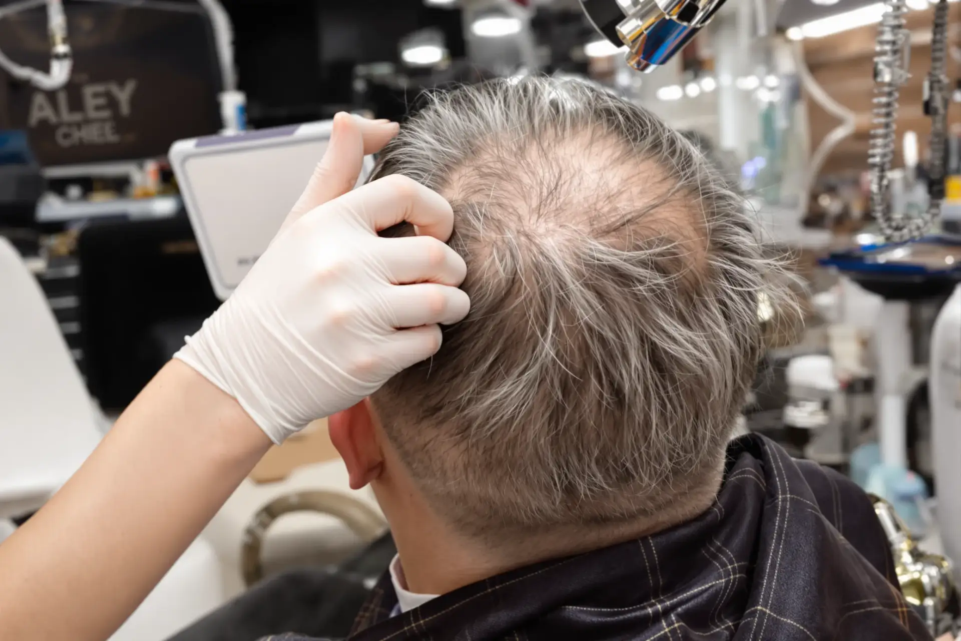 Harley Street Hair Transplant: What It Really Costs