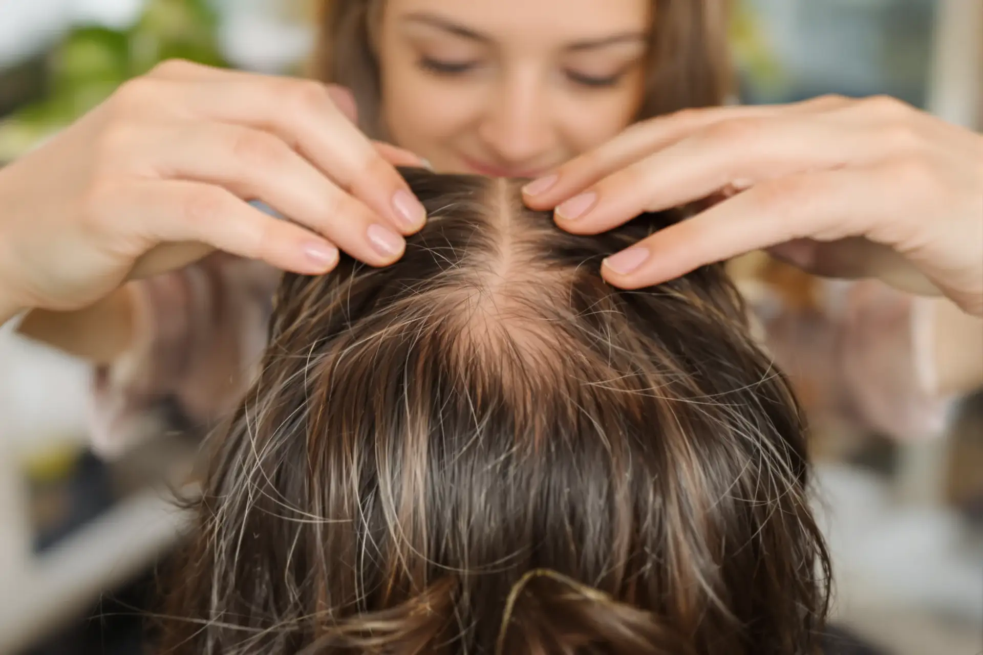 Quanti capelli si perdono al giorno: la media