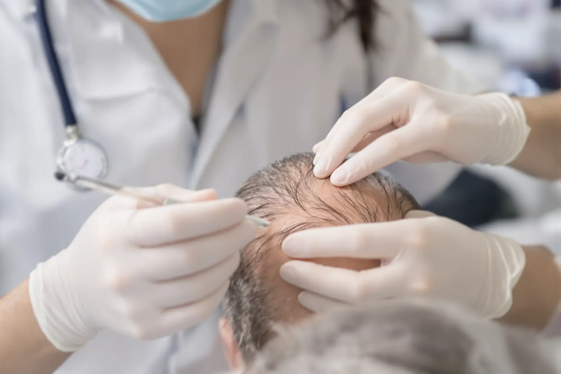 Turkey Hair Transplant Safety 2026: Data-Backed Verdict