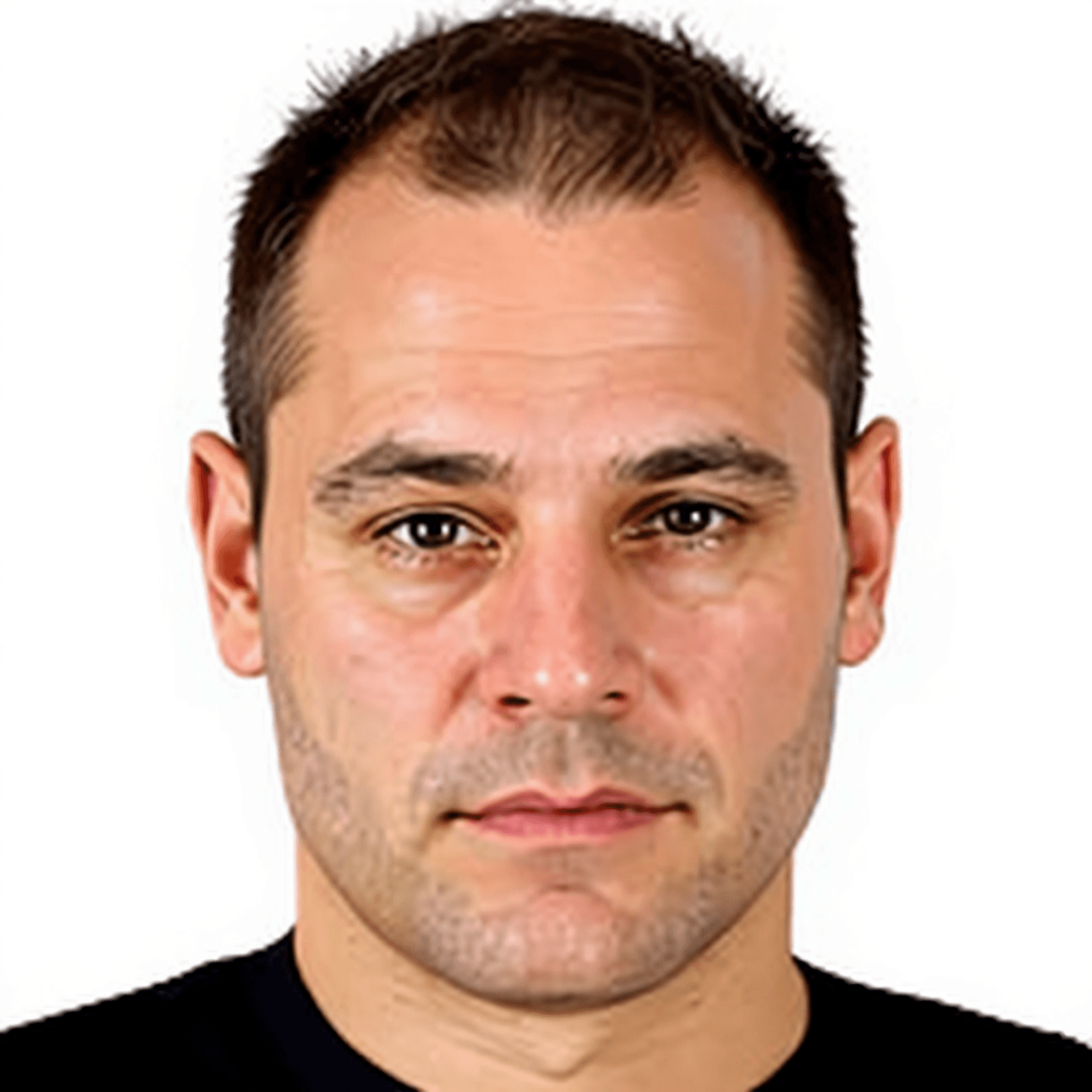LeBron James Hairline: The Celebrity Hairline Case Study