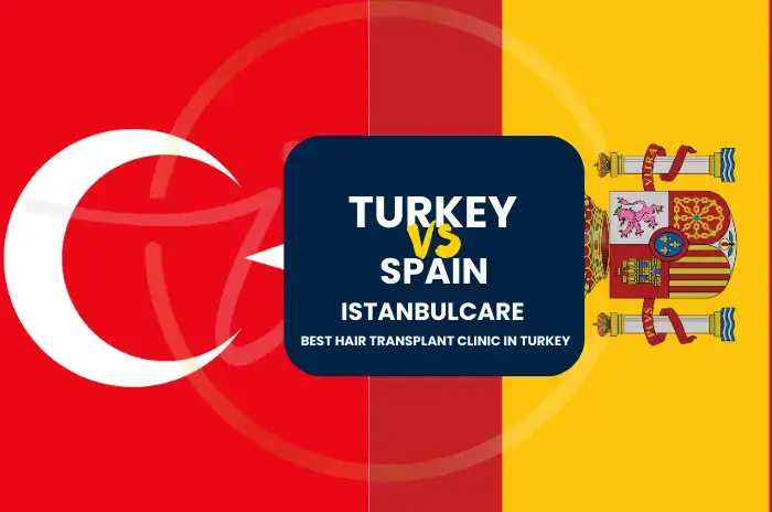 Costo del trapianto di capelli: Turchia vs. Spagna
