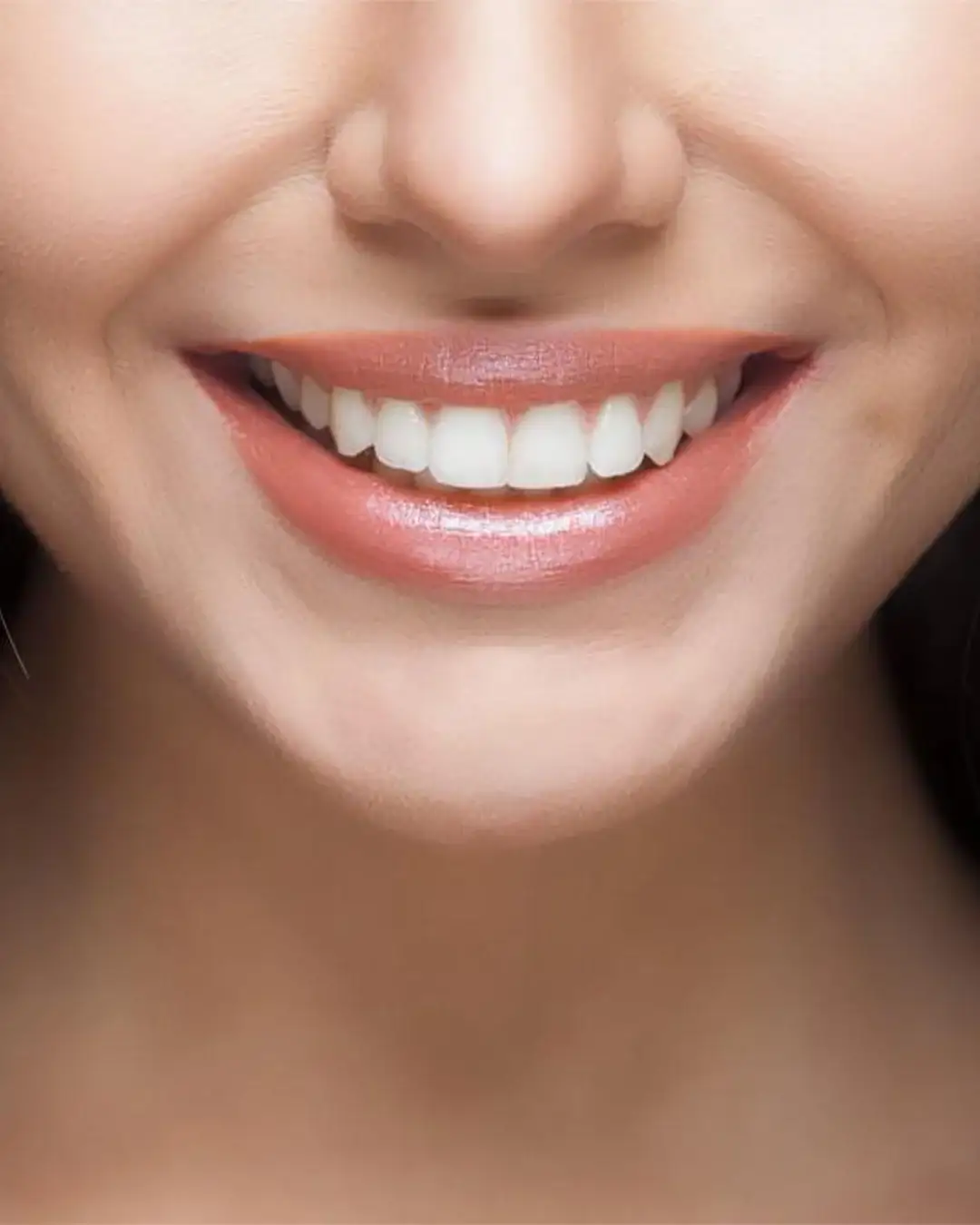 Mujer sonriendo con dientes blancos brillantes y un aspecto cuidado.